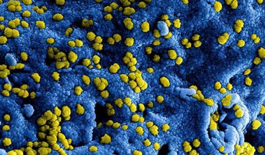 Corona-virus (Covid-19)